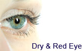 Discount Contact Lenses: Dry Eye Drops & Red Eyes Allergy Relief From $5.25